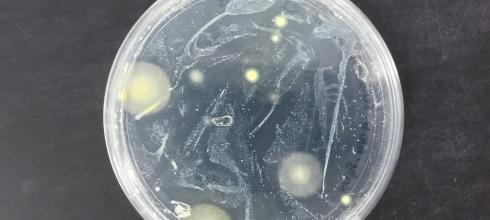 Fungal cultures from sea turtle nest sites grow quickly on a Petri dish in the lab