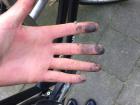 My dirty hand after fixing the chain on my bike