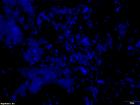 An example of what cells look like in 2.D.; these cells were stained blue for imaging as a part of my microscope training!