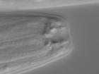 P. pacificus worm with the stenostomatous, or narrow, mouth form (photo by Tobias Loschko)