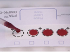 Blood samples for testing